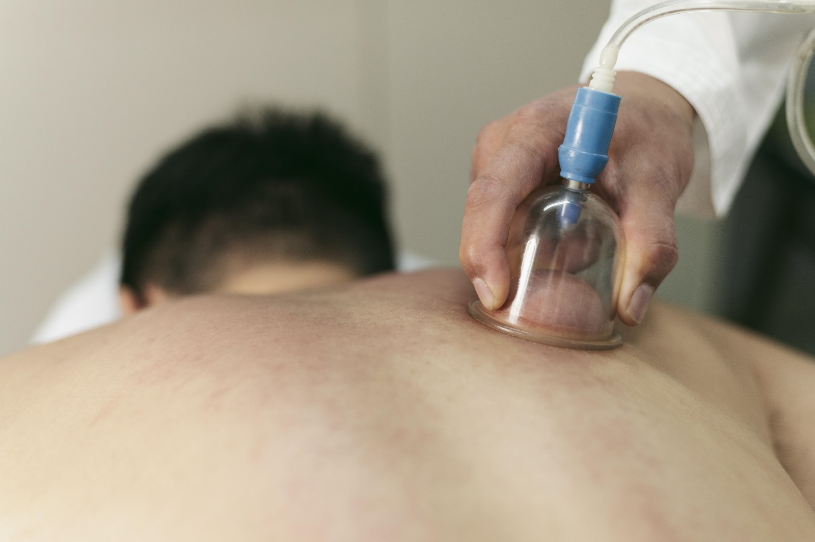 Myofascial Cupping Massage